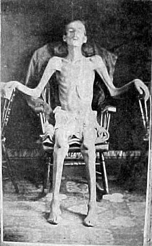 Civil War Prisoner.jpg